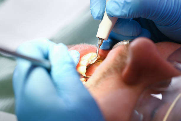 Best Holiday Emergency Dentist in Black Forest, CO