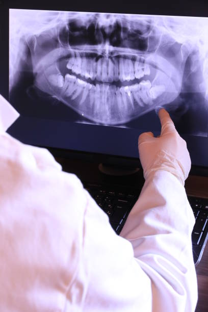 Best Emergency Dentist for Lost Fillings or Crowns in Black Forest, CO